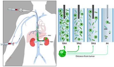 Endovascular image-guided sampling of tumor-draining veins provides an enriched source of oncological biomarkers